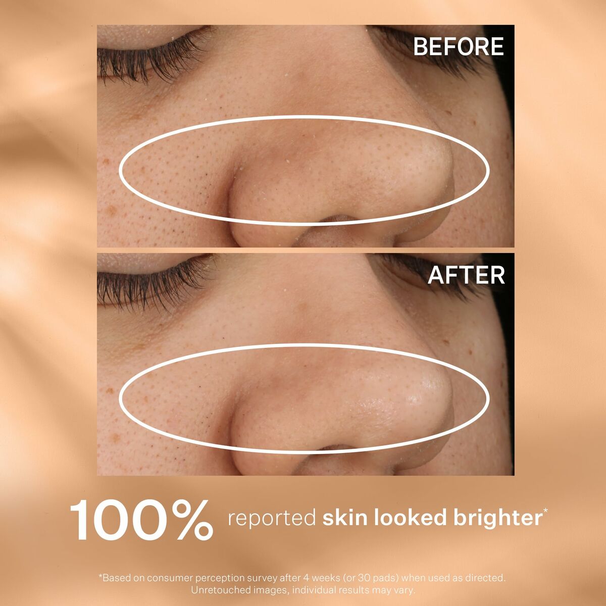 V3H72432FC4EC50195EE2436F7FD6A0062ER7352206P6