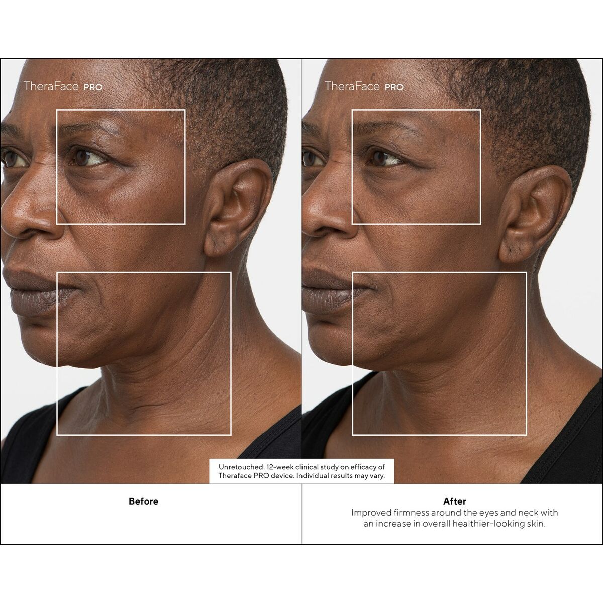 V5H24968A7E94E9DF67B31BD54103E15105R4939059P9