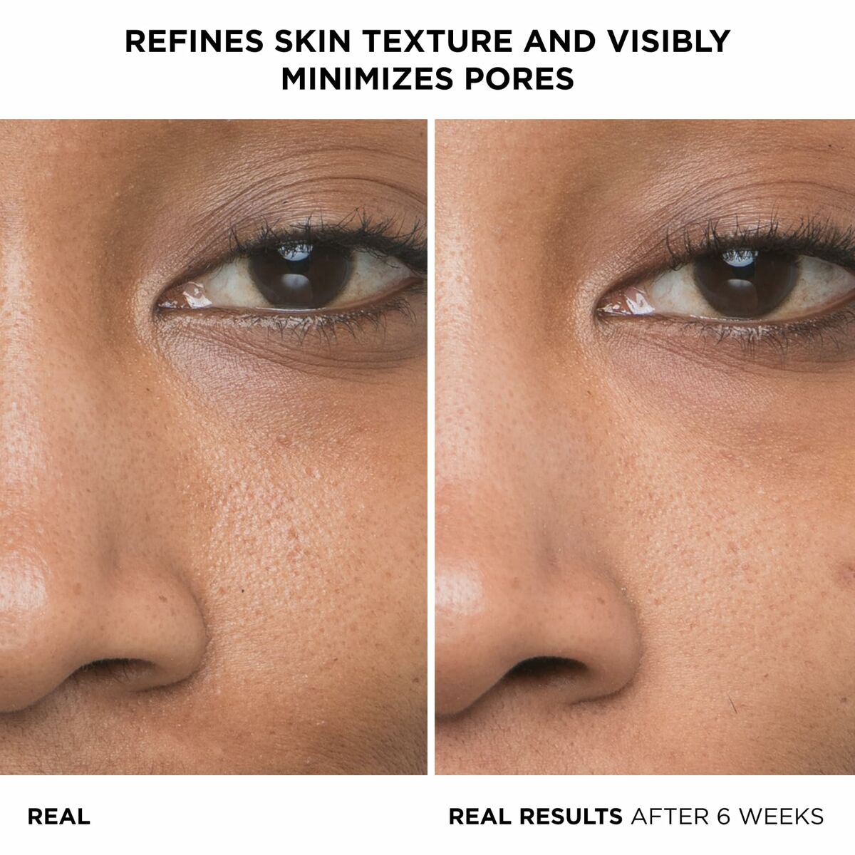 V4HF2281436D8A6B60CE932DF778EB98B34R6238555P2